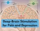 Deep-Brain Stimulation for Pain and Depression