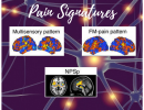 Differences in brain activity among individuals with fibromyalgia and normal controls