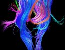 the brain connectome