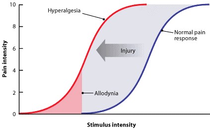 Graph showing the relationship between pain intensity and stimulus intensity. Allodynia occurs when the stimulus is weaker and hyperalgesia when the stimulus is stronger